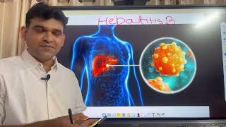 Hepatitis b treatment drniteshraj [upl. by Ron239]