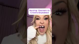 Veneers vs crowns veneers [upl. by Parfitt]