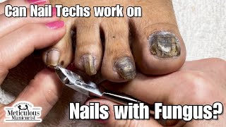 Pedicure Nail Fungus Transformation [upl. by Annoif]