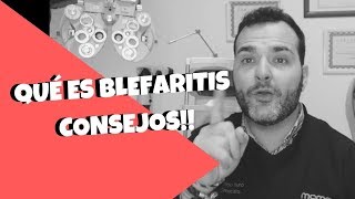 BlefaritisConoce Qué Ocurre En Tus Ojos  CONSEJOS [upl. by Fezoj]