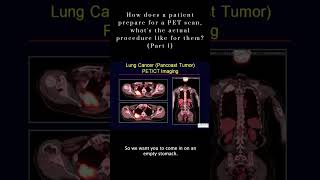 Pet Scan Procedure  Part 1 Shorts YoutubeShorts [upl. by Dickman]