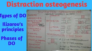 Distraction Osteogenesis partI [upl. by Ydnir385]