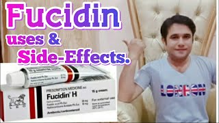 fucidin cream uses and side effects [upl. by Eelyma]