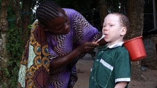 Albinos look for safety on Tanzanias Ukerewe Island [upl. by Cavanaugh]