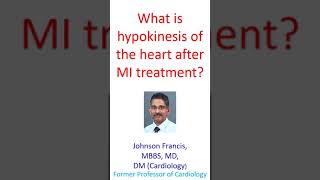 What is hypokinesis of the heart after MI treatment [upl. by Eleahcim]