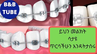 ይህን መልክት ከሰማቹ በኋላ ለብሬስ ያላቹ አስተያየት ይቀየራል፡፡ ክፍል 1 Why is it Important to have Braces [upl. by Mcnair]