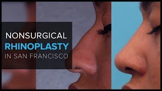 Non Surgical Rhinoplasty quotLiquid Nose Jobquot With Dermal Fillers at Mabrie Facial Institute [upl. by Eceeryt112]