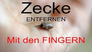 Zecke entfernen mit den FINGERN [upl. by Odraleba622]