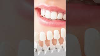 Proper Dental Crown Procedure 5 Useful Aftercare Tips [upl. by Brianna]