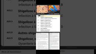 A03 Shigellose [upl. by Agueda]