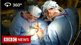 In 360 Oesophageal cancer operation filmed  BBC News [upl. by Taft]