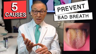 Top 5 CAUSES of BAD BREATH  How to Prevent it [upl. by Orford]