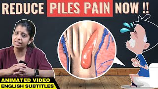 Animation Piles Pain Relief Hemorrhoids  மூல நோய் குணப்படுத்த எளிய வழிகள் [upl. by Arammat548]