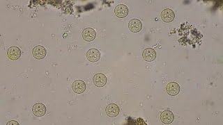 entamoeba histolytica under microscope 🔬 AlaaRezq [upl. by Chery]