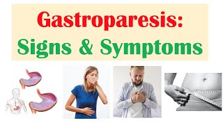 Gastroparesis Signs amp Symptoms ex Nausea Abdominal Pain Weight Loss [upl. by Hortensa]