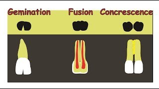 Fusion Gemination amp Concrescence [upl. by Meadows]