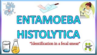 Entamoeba Histolytica  Morphology of the Trophozoite amp Cyst on Light Microscope Stools for AOC [upl. by Mariana39]