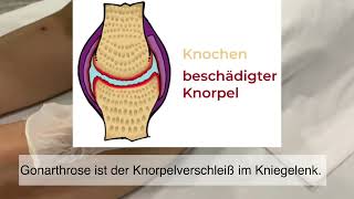 Akupunktur bei Arthrose mit MA35 und GB34 Akupunkturpunkten By DrTCM BEIJINGampWIEN [upl. by Fortunia]