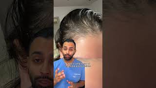 Hair Loss Before amp After with PRP amp Polynucleotides  Dr MediSpa [upl. by Onida269]