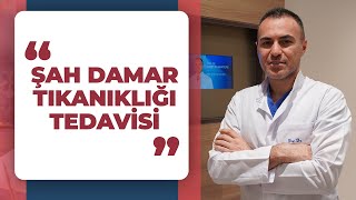 Karotis Arter Şah Damarı Tıkanıklığı Nasıl Tedavi Edilir  PROF DR MERT DUMANTEPE [upl. by Gemperle]