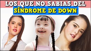 Sindrome de down  curiosidades que no sabias [upl. by Zurheide942]