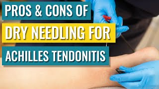 Dry Needling For Achilles Tendinopathy  Tendonitis — Does It Help [upl. by Haman]