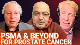 PSMA and beyond PSMA for Prostate Cancer [upl. by Connolly]