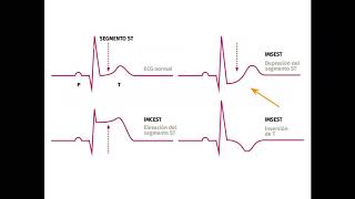 M7P3 Curso de electrocardiografía clínica “Prof Hiram Collard”  Cát de Semiología HNCFCMUNC [upl. by Haldis]