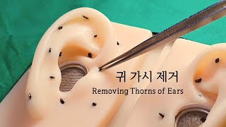 ASMR 귀에서 자란 딱딱한 가시 제거하기｜Removing Thorns of Ears｜Visual Triggers [upl. by Asaph911]