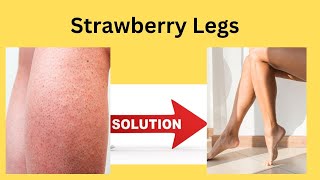 Strawberry Legs Solution  Malayalam [upl. by Kuo406]