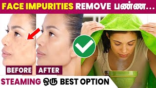 Benefits of Steaming Face  Glowing Skin at Home 😍 [upl. by Sakul875]