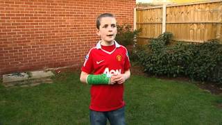 Meet the boy whose arm was broken by Wayne Rooney [upl. by Shipman]