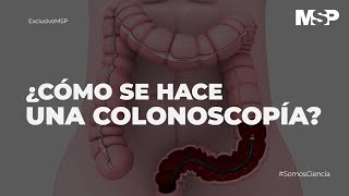 ¿Cómo se hace una colonoscopía ExclusivoMSP [upl. by Aitnom485]