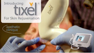 Introducing The Brand New Tixel For Skin Rejuvenation  Steven F Weiner MD [upl. by Leik442]