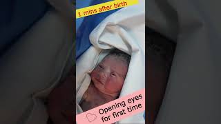 Cute newborn baby opening eyes for first time after coming out of mommys womb viralbaby [upl. by Lyrrad]