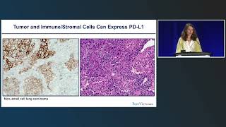 Gaining Confidence in Predicting and Assessing Response to Cancer Immunotherapies [upl. by Jones]