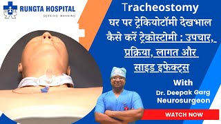 Tracheostomy Kya Hota Hai in Hindi tracheostomy care in hindi  How Tracheotomy is performed [upl. by Nnylrefinnej]