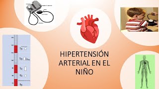 Hipertensión arterial en el niño [upl. by Millicent337]