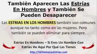 las estrias en hombres tambien se quitan [upl. by Narat]