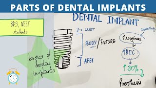 basics of dental implants  parts of implant [upl. by Tibbetts]