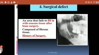 Differential Diagnosis Of Radiolucent Lesions LEC3Of Elearning [upl. by Mayap134]