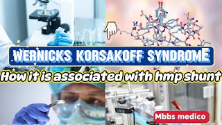 Wernicke korsakoff syndrome and how it is associated with hmp shunt hmp shunt disorders [upl. by Rinna378]