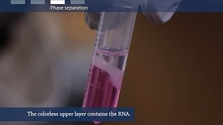 How to isolate RNA from tissue or cells [upl. by Una]