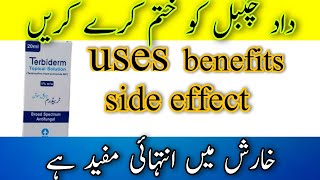 terbiderm lotion terbenafin hcl uses benefits side effectterbiderm lotion uses in urdu hindi [upl. by Ad]