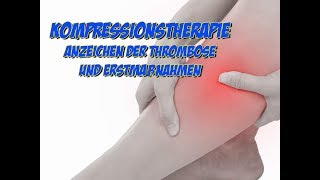 Kompressionstherapie  Symptome der Thrombose und Erstmaßnahmen [upl. by Anel874]