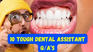 10 tough Dental Assistant Questions and answers [upl. by Kuth]