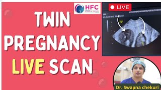 Twin Pregnancy LIVE Scan  TwinPregnancyJourney  Best IVF Center In Bangladesh  HFC [upl. by Fauver]