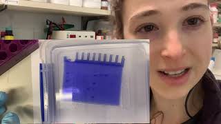 Coomassie Brilliant Blue Dye  the science of SDSPAGE staining [upl. by Gibe103]