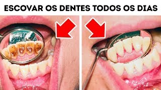 10 Erros Que Você Comete Ao Cuidar Dos Dentes [upl. by Anoved]