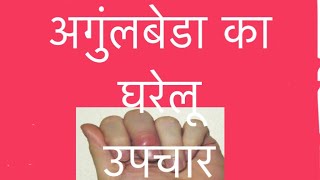 Angulbeda home remediesअंगुलबेडा घरेलू उपचार PARONYCHIA CURE [upl. by Iline]